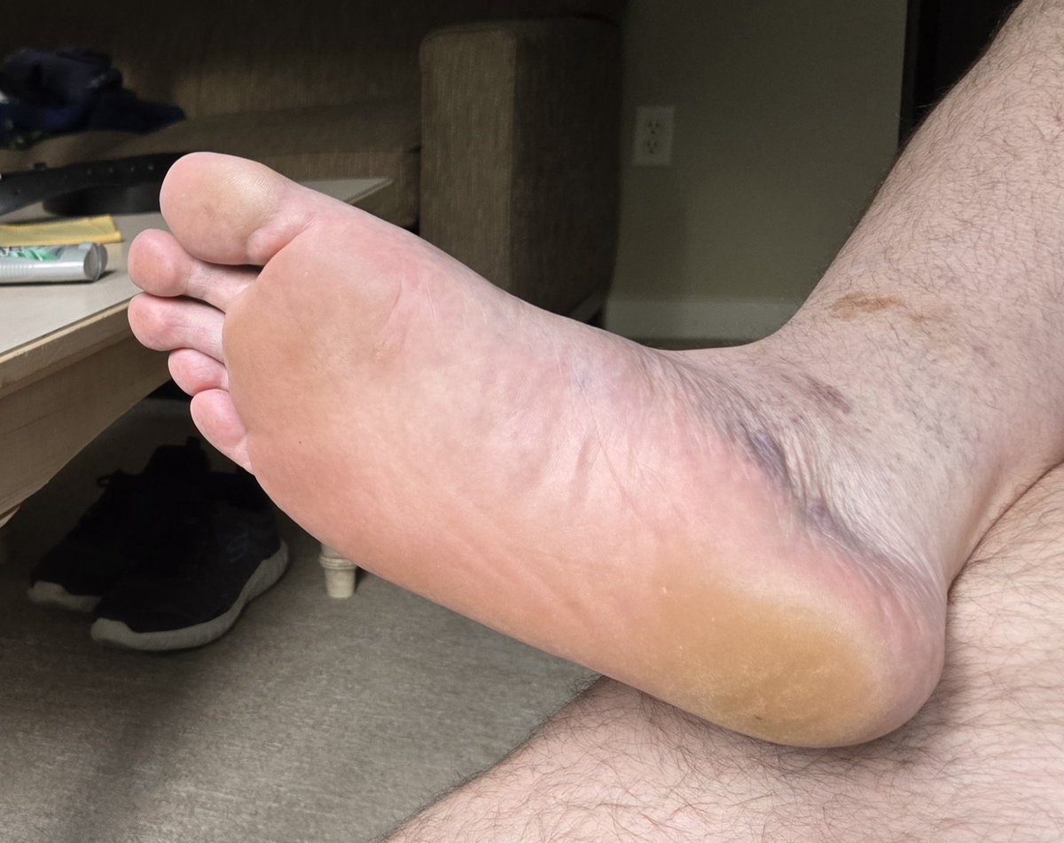 bigflatfoot14_tkl tweet media