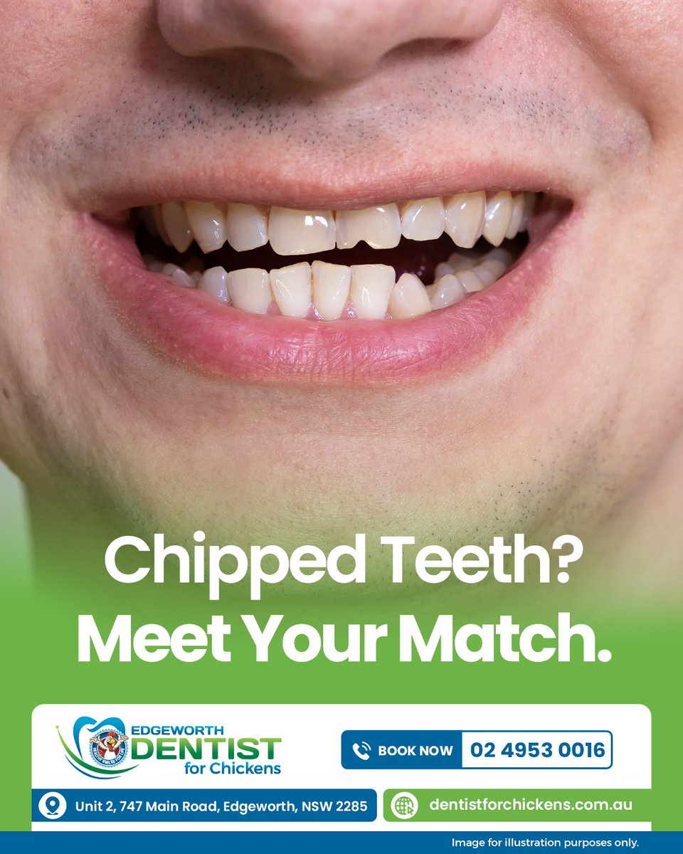 dfc_edgeworth's tweet image. Chips, cracks, and uneven edges don’t have to hold your smile back. Custom veneers at Dentist for Chickens are designed to fix imperfections quickly and naturally, giving you a confident, polished smile that still feels like you.

#DentistForChickens #Customveneers #Crackedteeth