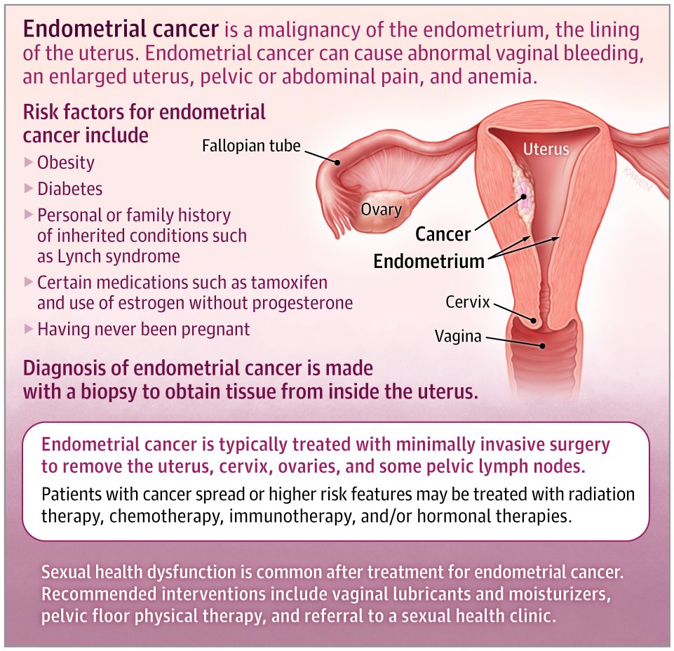 JAMA_current's tweet image. This JAMA Patient Page describes common symptoms and signs of #endometrial #cancer, how it is diagnosed and treated, and the prognosis. 

ja.ma/4t9ef7a