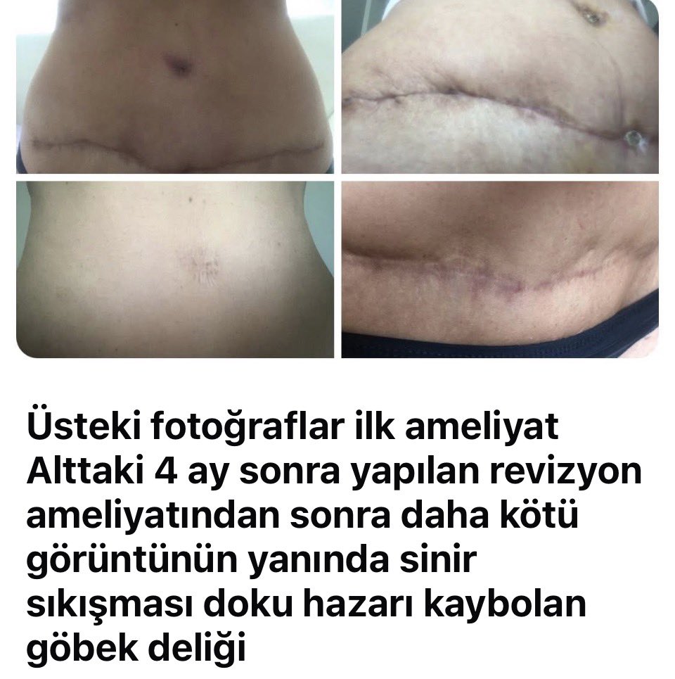 SerapMAR's tweet photo. https://t.co/Sg8ejkWweJ