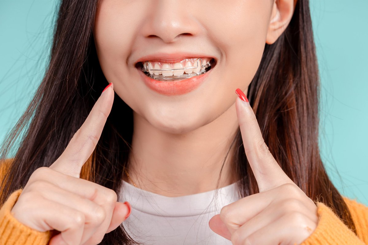 proaligners's tweet image. Teeth can shift back even after aligners or braces 😬 Retainers are key to keeping your smile straight long-term! 🦷✨
Read more: proaligners.co.uk/blog/retainers…
#Retainers #ClearAligners #Orthodontics #SmileTips #ProAligners