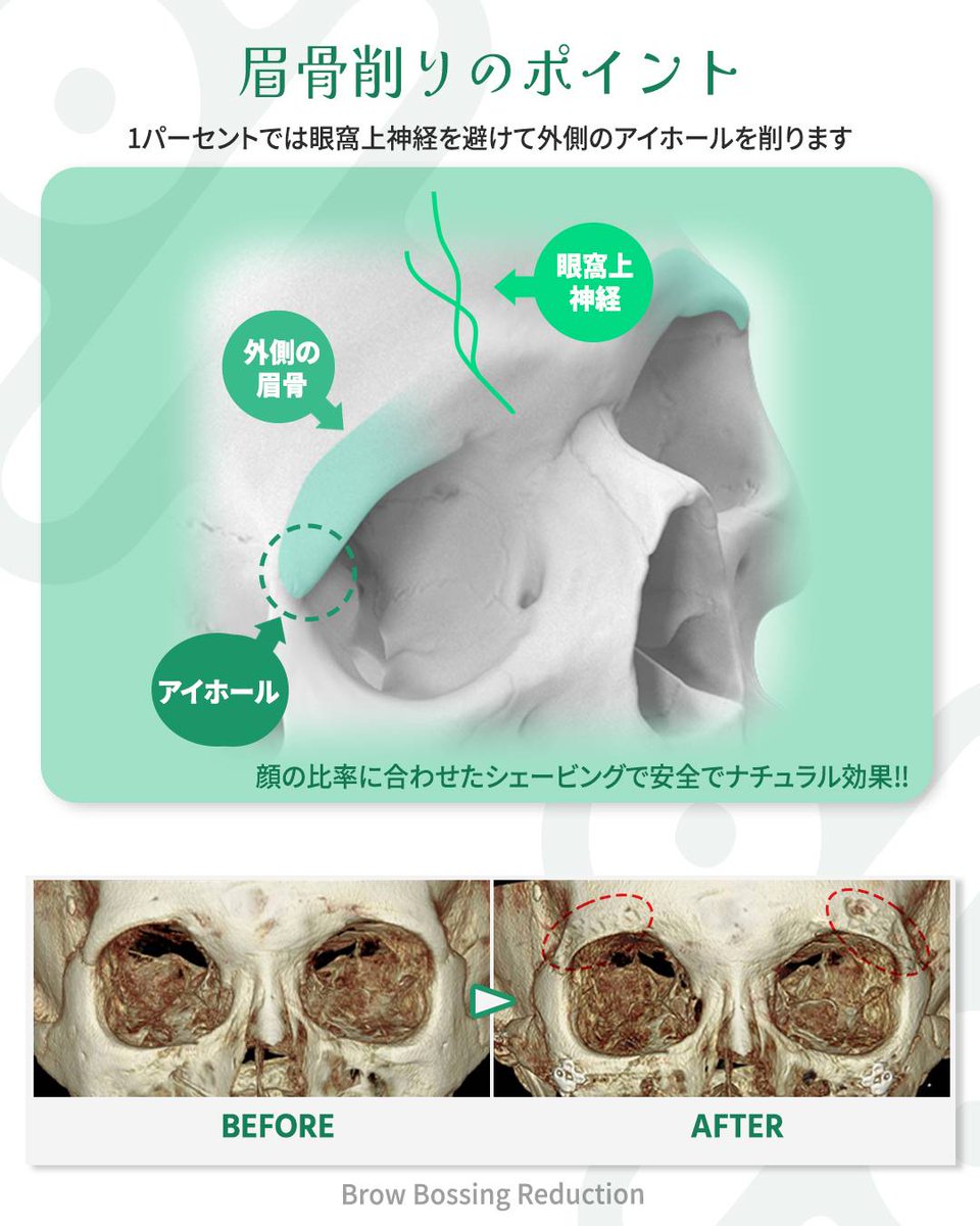 《両顎・輪郭整形専門》韓国1パーセント整形外科 tweet media