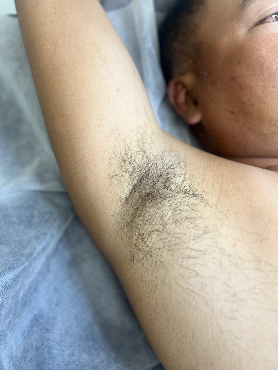 🎀高雄BOBO除毛+龍筋保養🎀 tweet media