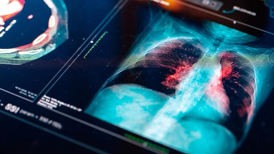 Radio Canada International Tagalog tweet media