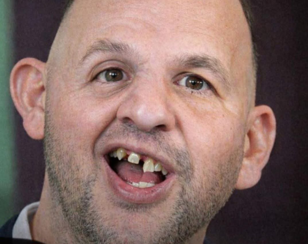 Badger Bites UK tweet media