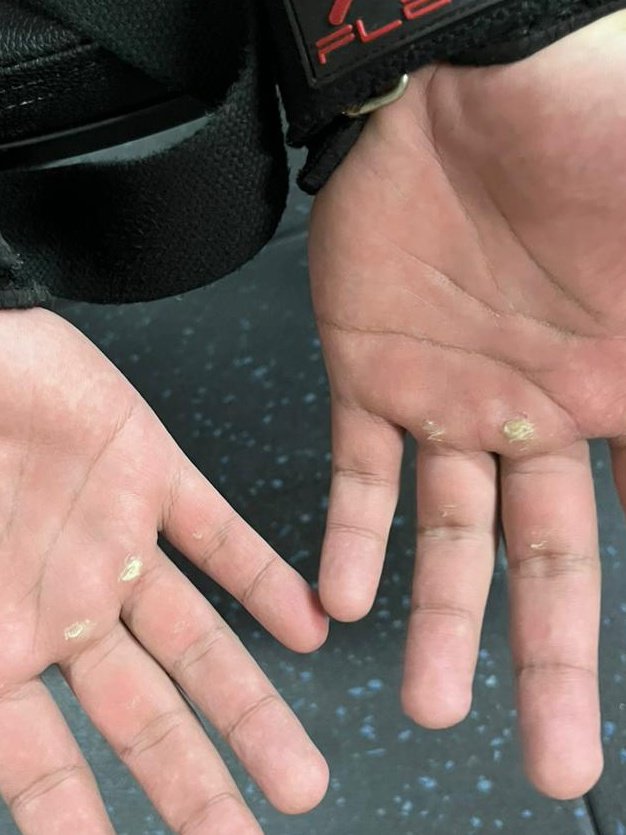 Use gloves when hit the gym ur FEMBOY
Using strap its BEGINNER
But raw you are a REALMAN with lil bit PTSD