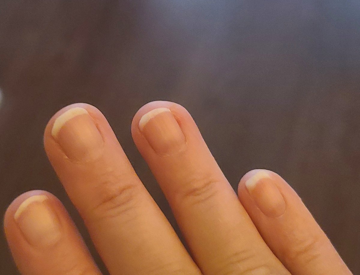 P. 🪷🐦‍⬛ tweet media