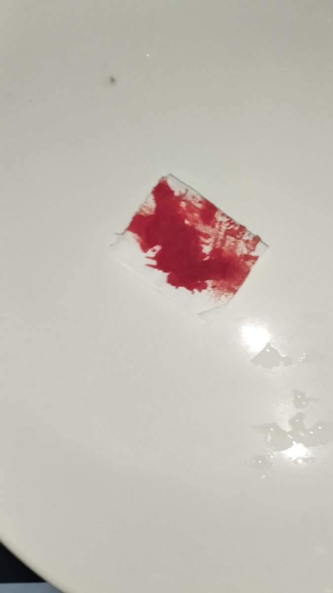 angel ~~ ifb ^^ / #shtwt / #kleptotwt - #lifttwt tweet media