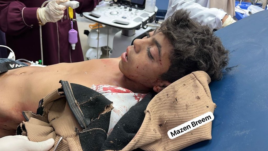 FalastineL's tweet photo. Photos | Injuries transferred at Nasser Medical Complex in an Israeli drone strike near Bani Suhaila Square in Khan Younis, southern Gaza Strip, a short while ago. https://t.co/FCNrjycK6g