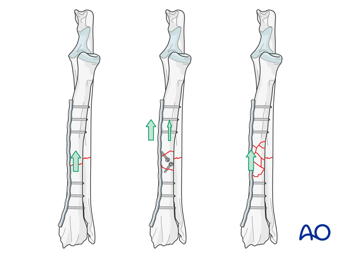 AOSurgery's tweet photo. 🐾 Now live on AO Surgery Reference: Reorganized Basic Techniques for Dogs &amp; Cats 🐾

➡️ https://t.co/LgZICamOLu

#AOSurgeryReference #AOVet #VeterinaryTrauma #FractureManagement #SmallAnimalSurgery #VeterinaryEducation https://t.co/vbV2kztJDT