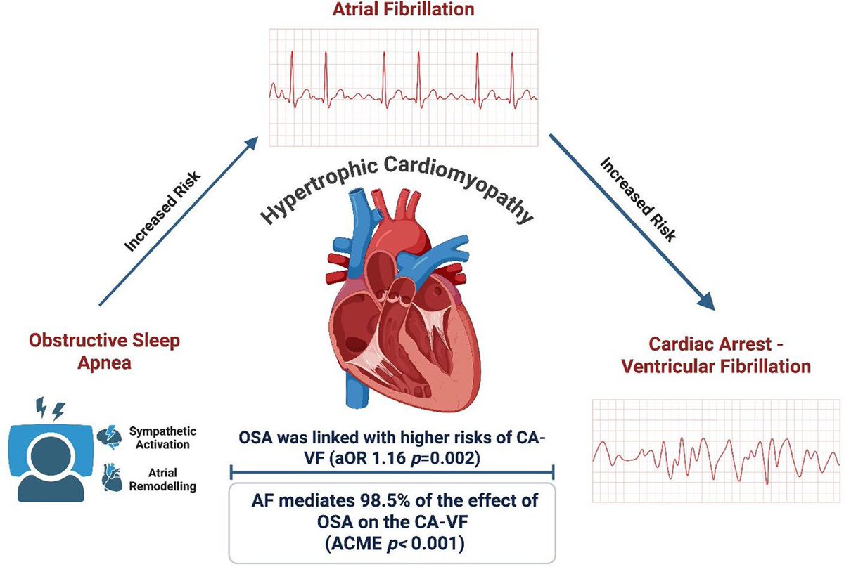 Progress in Cardiovascular Diseases tweet media