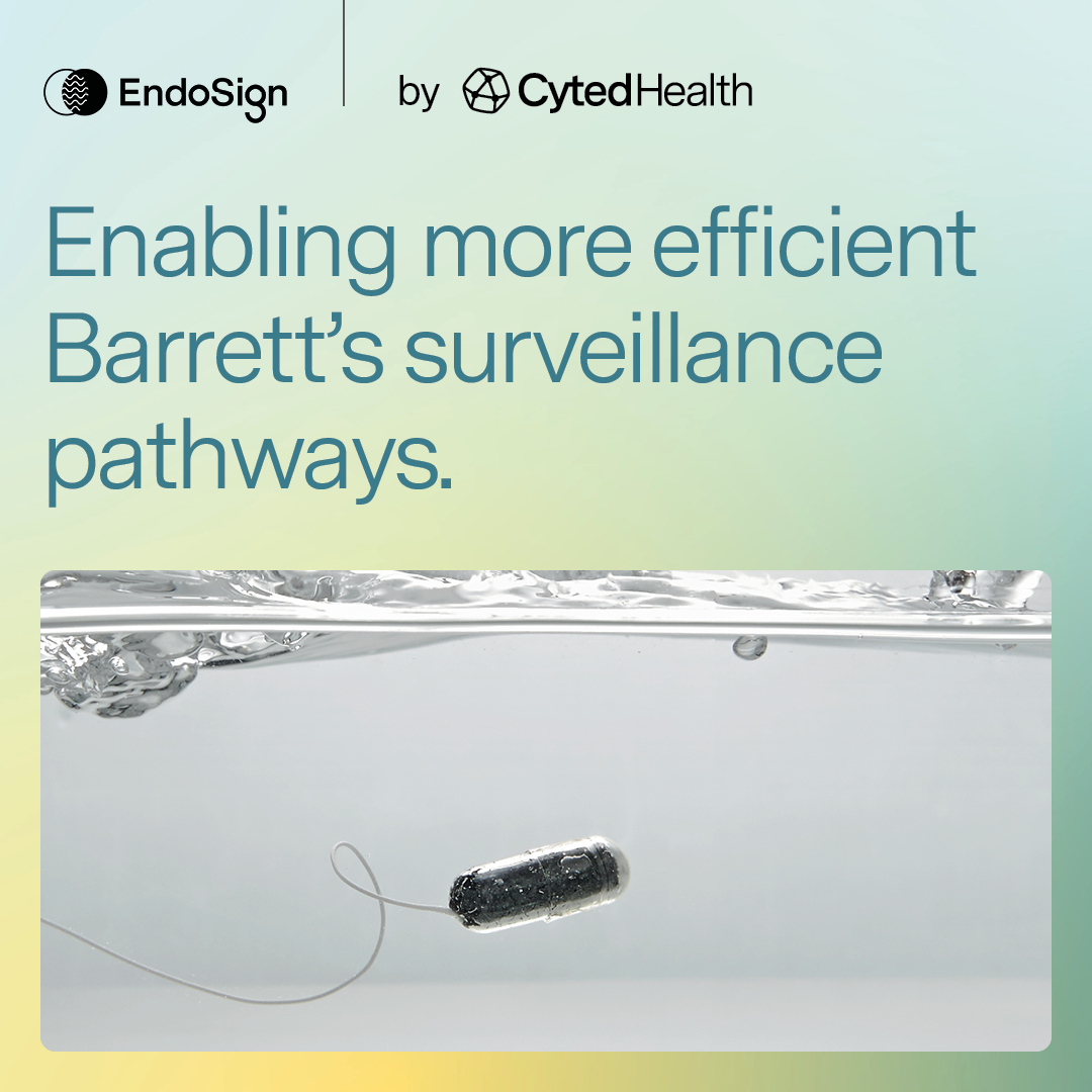 CytedHealth's tweet image. 1 in 100 people in the UK may require surveillance for Barrett’s oesophagus, creating sustained #endoscopy demand.

EndoSign® provides minimally invasive risk stratification, helping prioritise those most likely to benefit from endoscopy.

Learn more: endosign.com