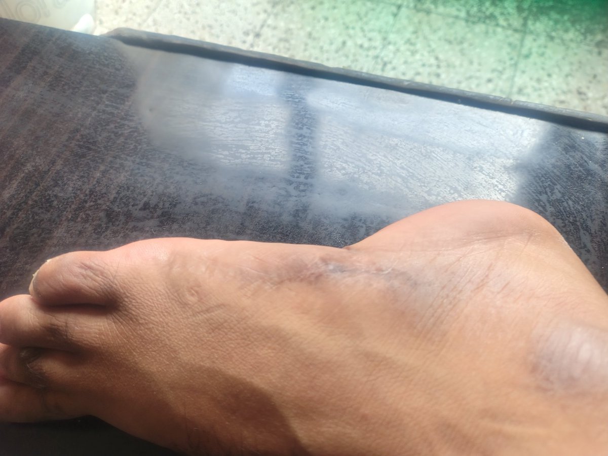 vippandit011's tweet image. मै पीड़ित सौरभ शर्मा 12 वर्षों से मेरा दुर्घटना मुआवजा  मामला मेरठ कोर्ट में लंबित है। 
माननीय उच्च न्यायालय से विनम्र निवेदन है कि मेरे मामले पर शीघ्र संज्ञान लेकर न्याय दिलाने की कृपा करें।
#JusticeDelayed #MeerutCourt #HighCourt #NeedJustice #VoiceForJustice