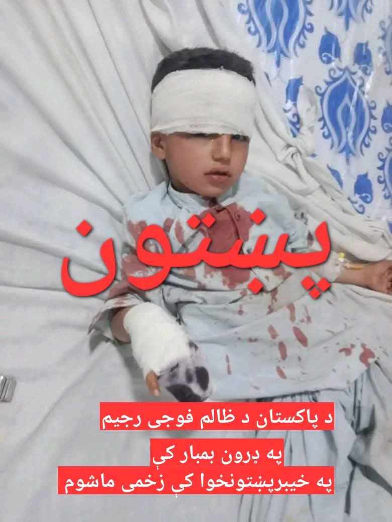 GDI_313_'s tweet photo. ادریس _بلعام بن باعوراء ته ووايه چې ستا حافظ سید عاصم منیر د کونړ ولایت ډېر بې ګناه مظلوم ماشومان شهیدان او زخمیان کړل، وس به ته بلعام بن باعوراء په دې وحشتناک قتل کې ورسره شریک نه یې؟ https://t.co/Bq3RsI7Ibu