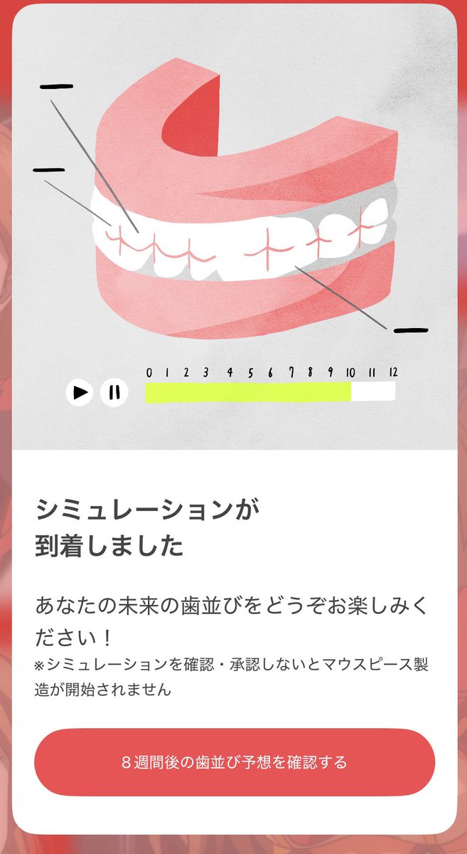 jzk_layer's tweet photo. うそやん!
8週間も伸びたんだけど!!
#ohmyteeth
うえー辛ー。
2ヶ月で終わると思って始めたのが、6ヶ月になってしもた... https://t.co/nGjY77InzT