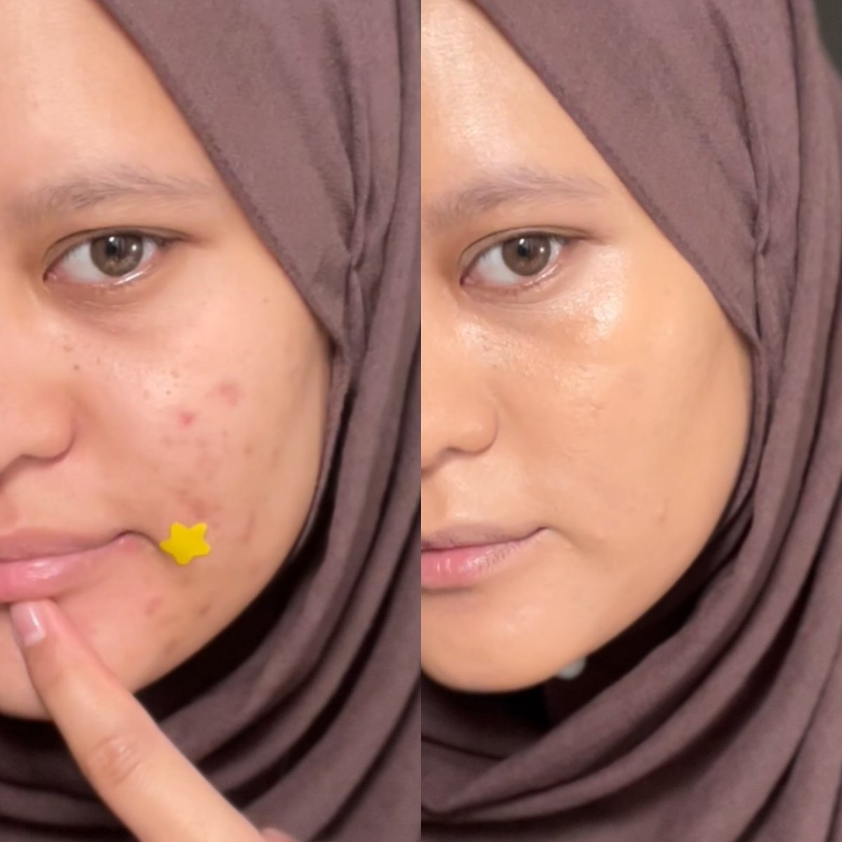velvetkeik's tweet photo. cushion lokal affordable, skin like finish, glowy cakep buat dry skin 😆
super ringannnnn gak berasa pake cushion 🫵🏻 https://t.co/7ODvTKpO8d