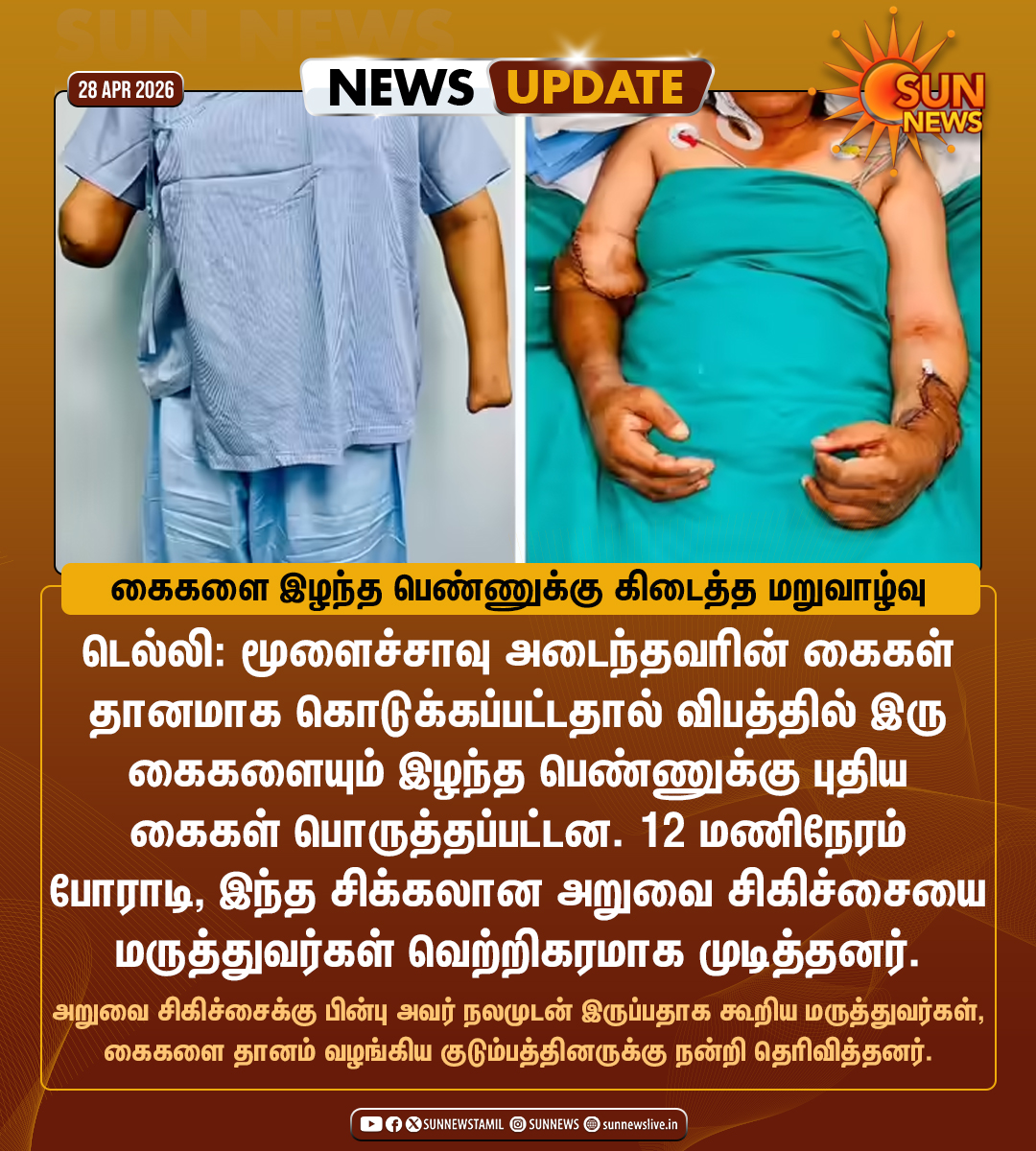sunnewstamil's tweet image. #NewsUpdate | மருத்துவ உலகின் அதிசயம்: கைகளை இழந்த பெண்ணுக்கு கிடைத்த மறுவாழ்வு

#SunNews | #Delhi