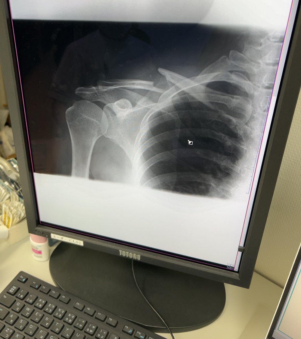 にとちゃん tweet media