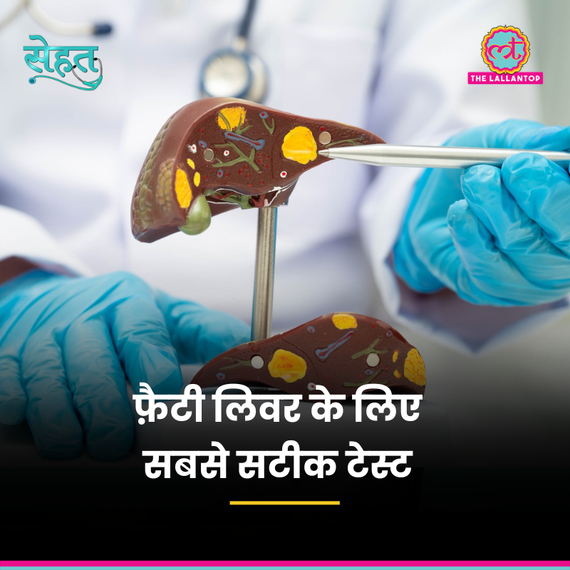 TheLallantop's tweet image. 'सेहत' में डॉक्टर से जानेंगे, क्या फ़ैटी लिवर के शुरुआती लक्षण दिखते हैं? फ़ैटी लिवर पता करने के लिए कौन-सा टेस्ट कराना चाहिए? Fatty Liver के कारण किन बीमारियों का रिस्क बढ़ जाता है और इसका इलाज क्या है?

Link: youtube.com/watch?v=OTi4kz…

@agni_aadi @NehaDhiman1004  #Sehat #Health