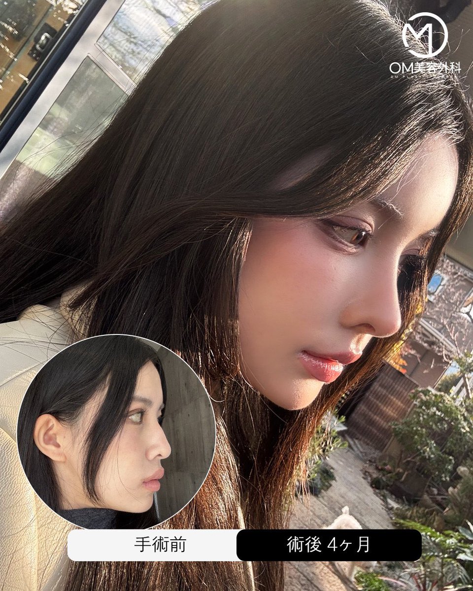 🥟7月額縮小 tweet media