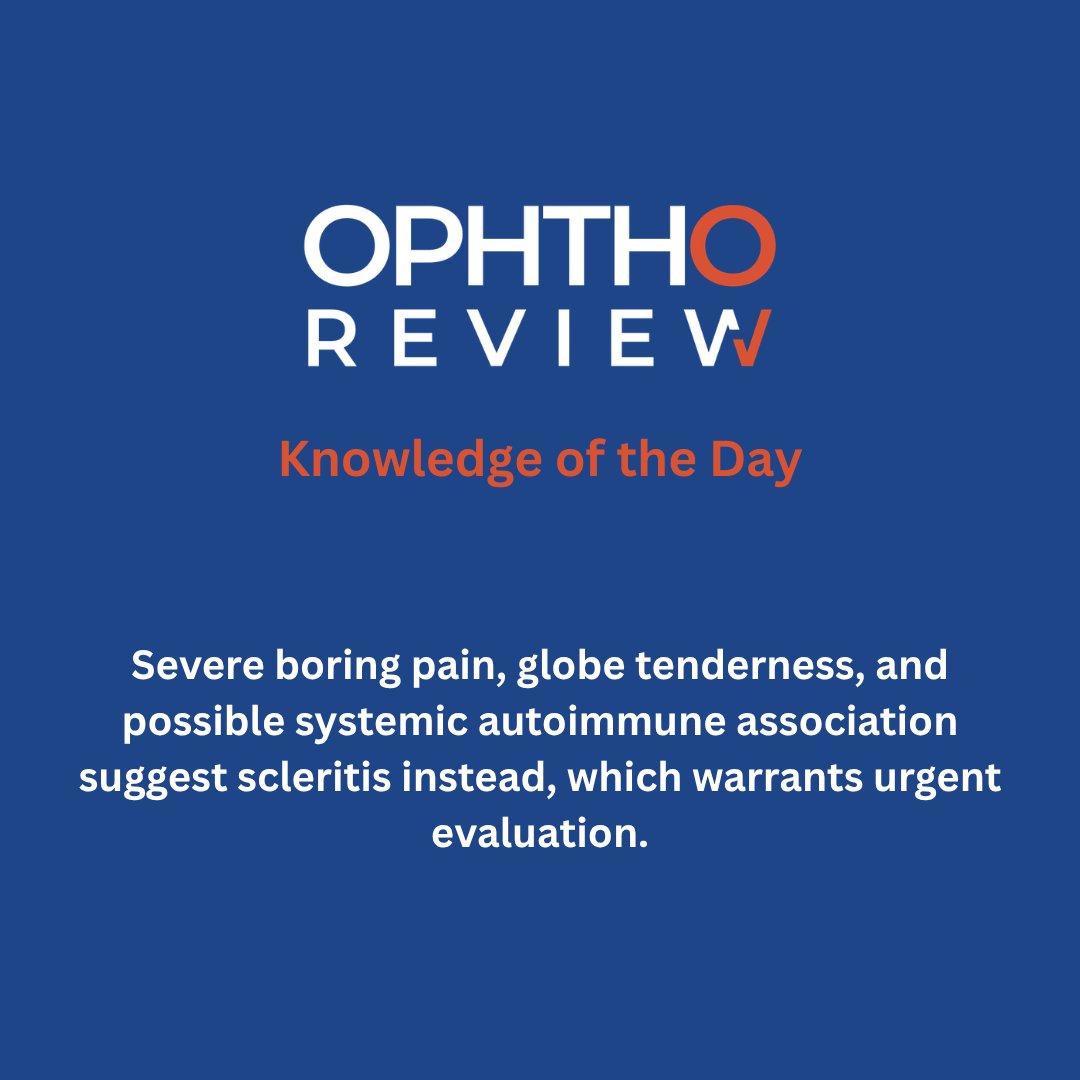 ophthoreview's tweet image. Episcleritis

#ophthoreview #ophthalmology #ophtho #ophthalmologyresidency #ophthalmologist #surgicaleducation #medicaleducation #meded #surgery #medicalstudent #medicine #medicalschool #resident #residency