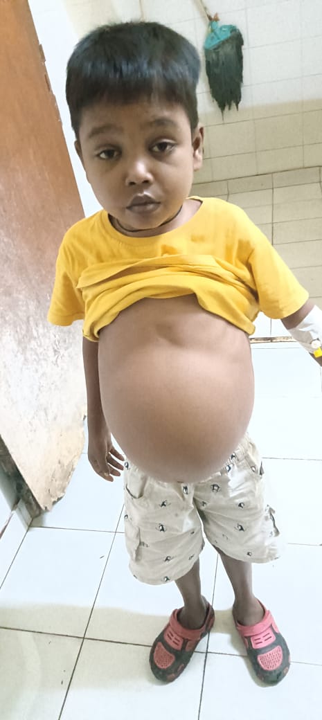 BhartiHaque's tweet photo. माननीय @HemantSorenJMM सा. Blood separation unit मशीन हजारीबाग सदर अस्पताल ब्लड बैंक में उपलब्ध ना होने के कारण थैलीसीमिया पीड़ित बच्चों को काफी दिक्कतों का सामना करना पड़ रहा है। Whole blood चढ़वाकर इनकी उम्र घटते जा रही है।
कृपया संज्ञान लें।
सधन्यवाद! https://t.co/Z03jjaYnIX