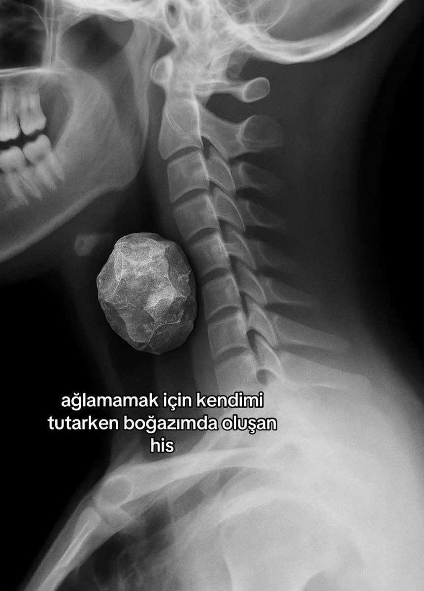 selin (@bosverselinn) on Twitter photo 