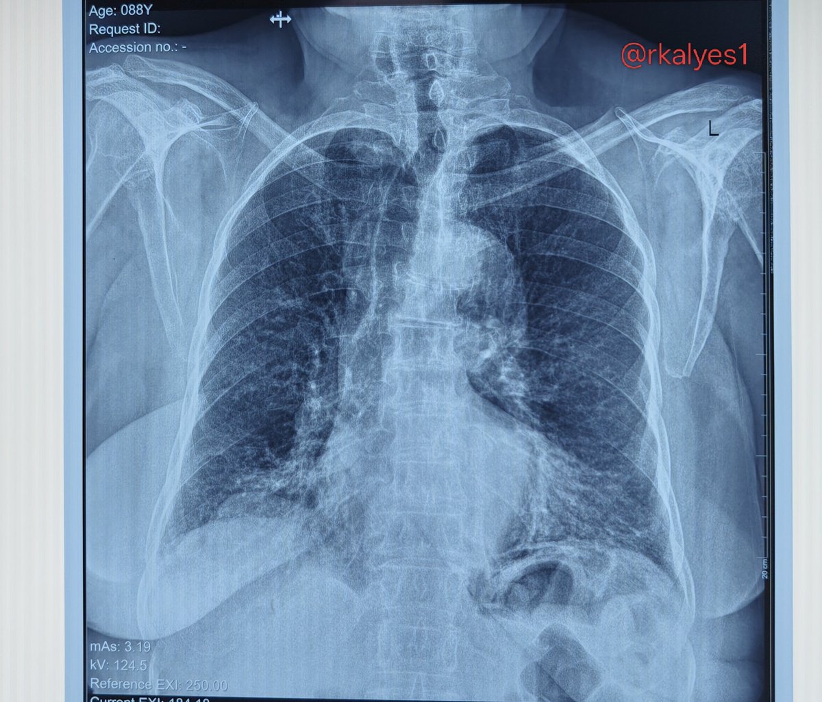 Robert Kalyesubula,MD, FISN(USA), PhD-FRCP(London) tweet media