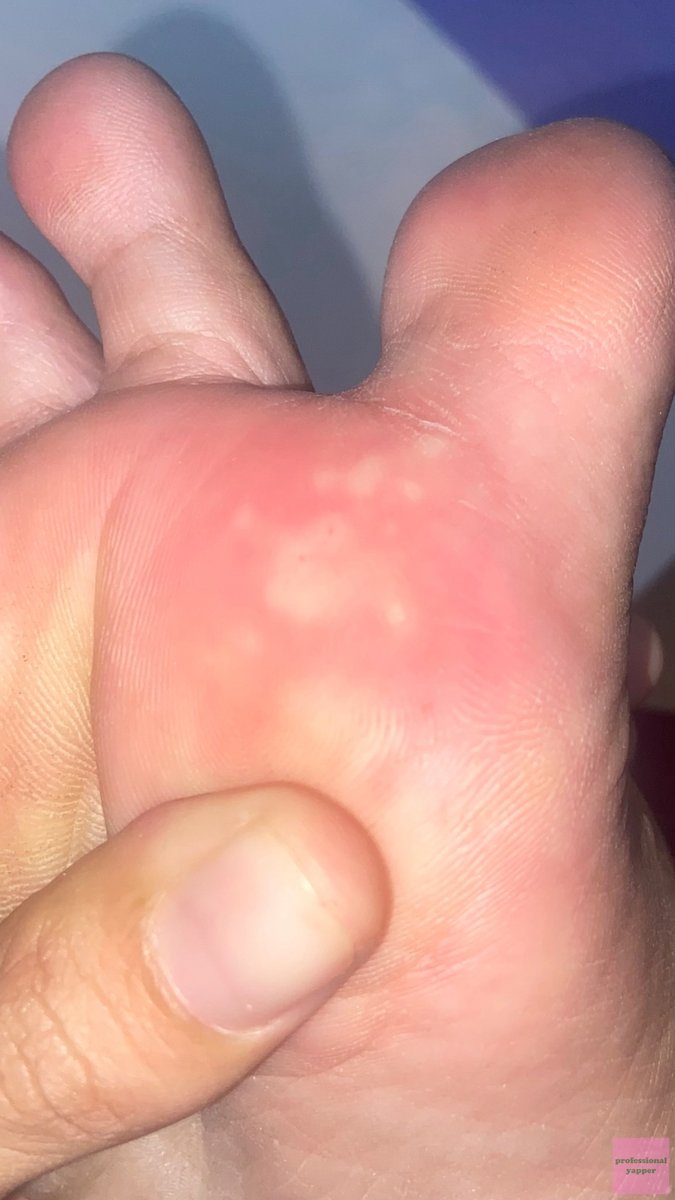 YAPPINGFESS tweet media