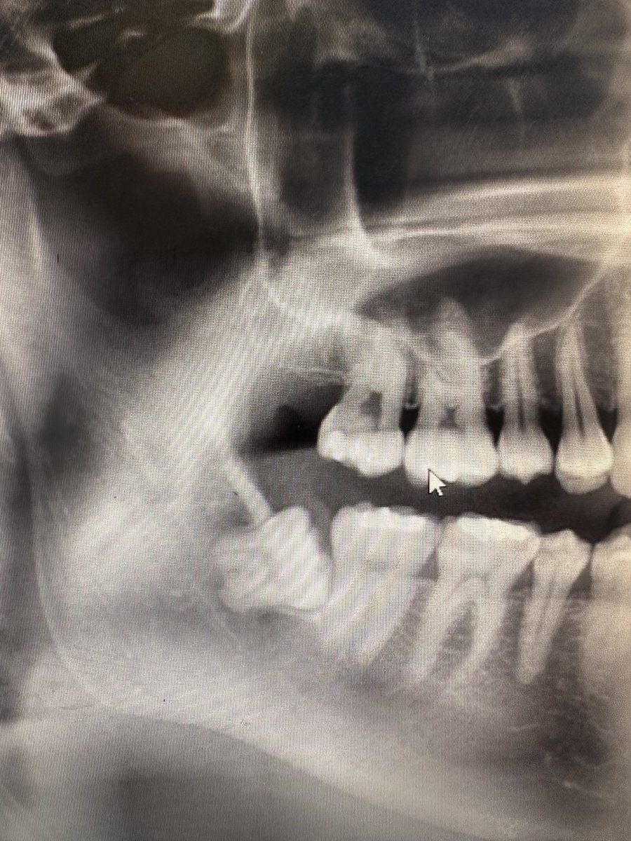 ariayong tweet media