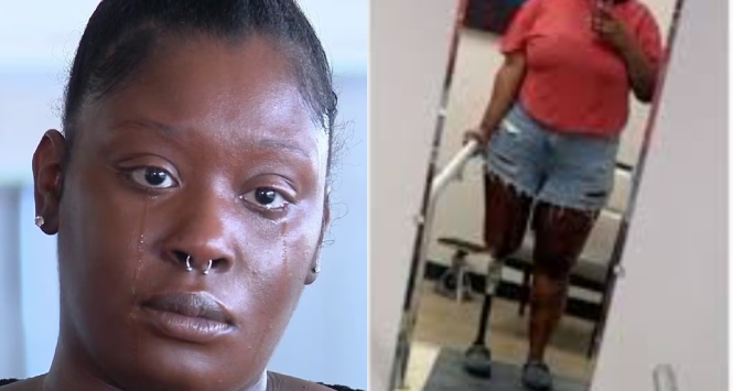 shinemycrown's tweet image. Maryland Woman Award $18 Million After Delayed Care Led to Leg Amputation shinemycrown.com/maryland-woman… #Maryland #Amputation #MedicalMalpractice #JusticeServed #HealthCare