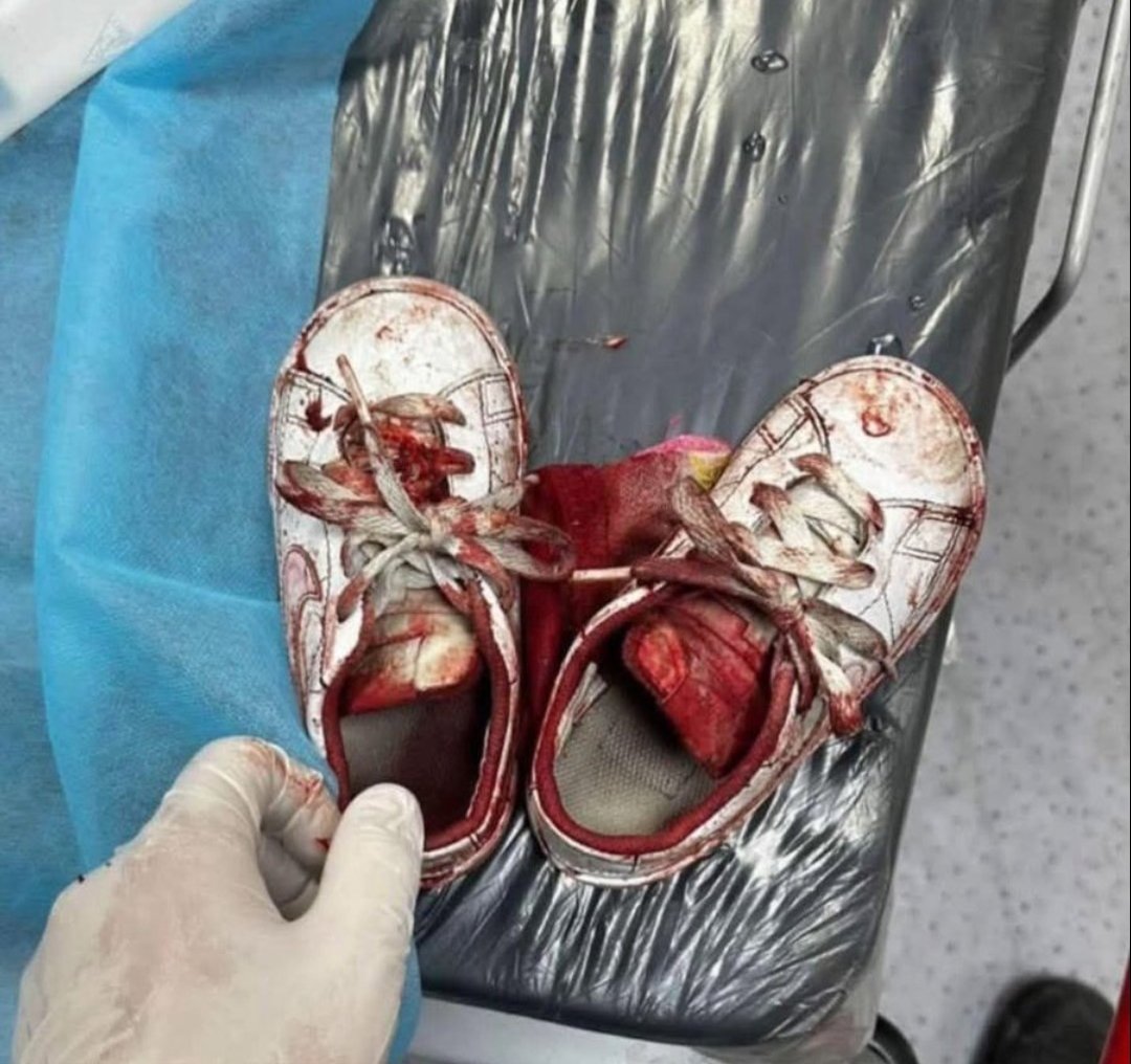 Yousef in Gaza 🇵🇸 tweet media