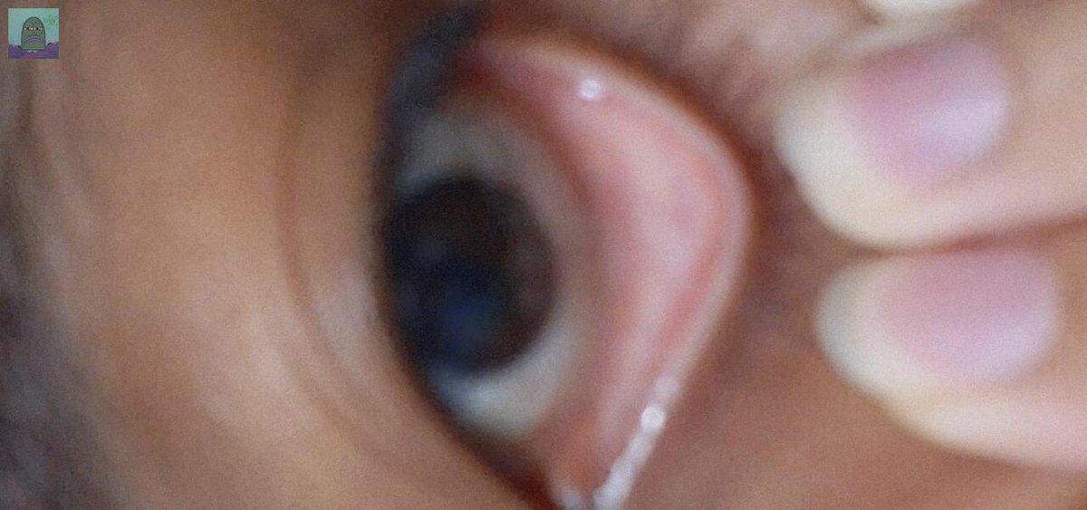 Tanyarl 💚 tweet media