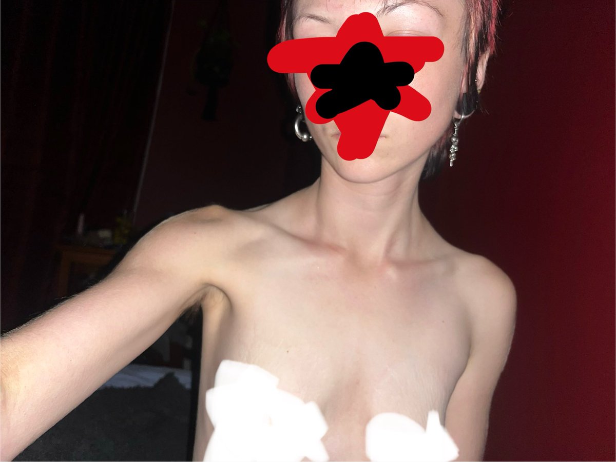 hangedmansbones's tweet image. I was gripping my vape the whole time #edtwt #bodycheck #thinspo ik I look bigger than I am but I’m bmi 14.8 😛