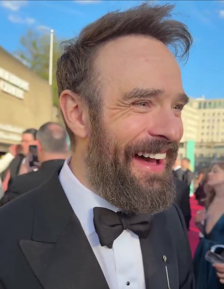 fuzz #1 charlie cox hairline defender tweet media