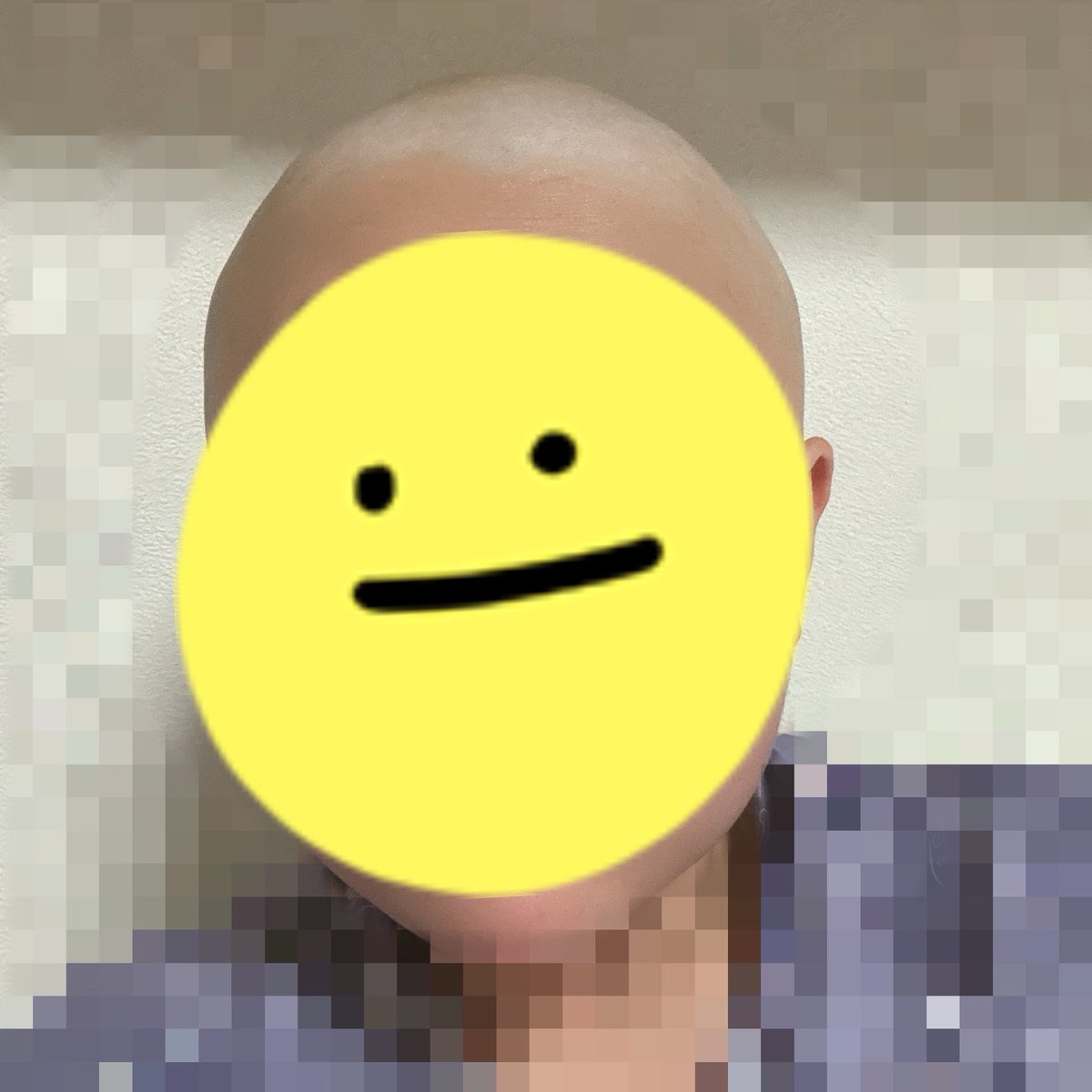 mogmog9170's tweet image. 数日前、坊主にしたんだけど。
坊主でも毛は抜けるんだよね。
気になって仕方ない私。
お風呂で剃っちゃった。
スキンヘッドに進化👨🏻‍🦲✨
ペタペタで気持ちいい、スッキリ。
 #抗がん剤
 #脱毛