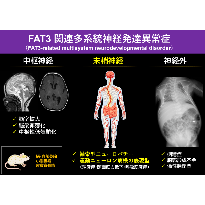 Press__official's tweet photo. 【鹿児島大学】FAT3遺伝子の変異による新たな神経疾患を発見！進行性の末梢神経障害と全身症状を伴う「FAT3関連多系統神経発達異常症」を提唱