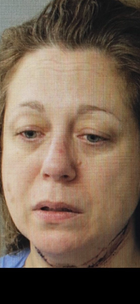scooperon7's tweet image. Just in: Bennington Vermont Police release mug shot of Janette MacAusland showing visible neck injuries following her arrest as a fugitive from justice from Wellesley on charges she murdered her 2 children ages 6 and 7…the accused killer is due in court tomorrow #7News