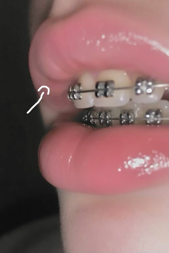 𝒄𝒓𝒂𝒔𝒉 tweet media