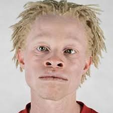 Enno Lolling tweet media