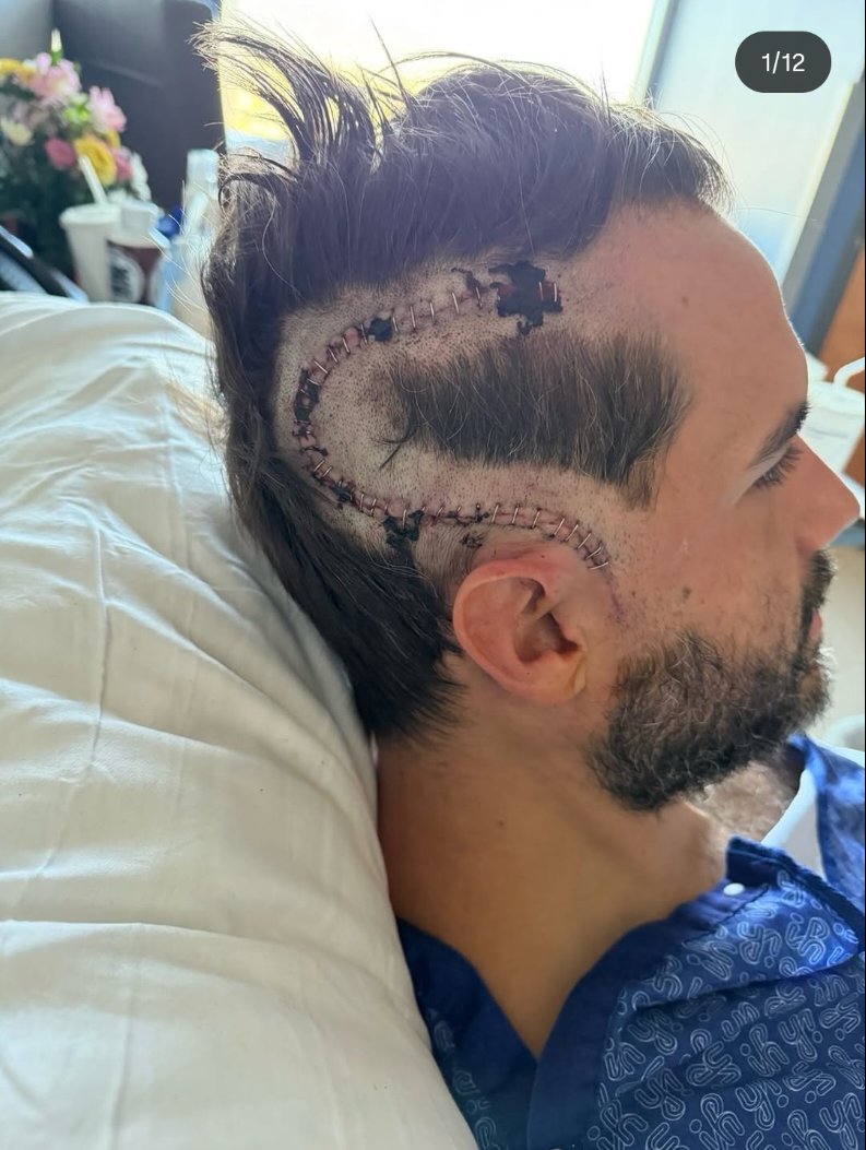 Friend in need.
Anything helps.

gofundme.com/f/dougs-fight-…