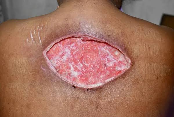 Sir Payoo🥼🩺 tweet media