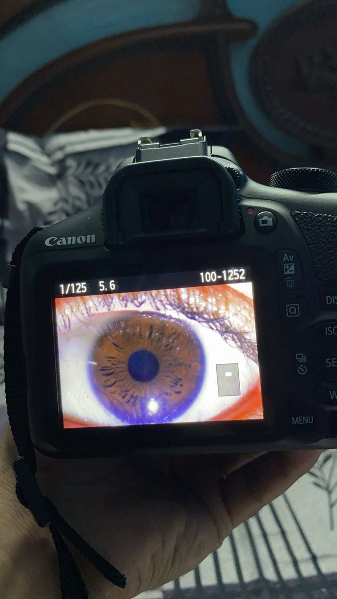 ayyussh04's tweet image. It’s all in the details. Pushing the limits with some intense macro photography today. The human eye is a whole universe of its own. 👁️📸
• Hashtags: #MacroPhotography #CanonCamera #VisualArt #CreativeDetails #PhotographyLovers