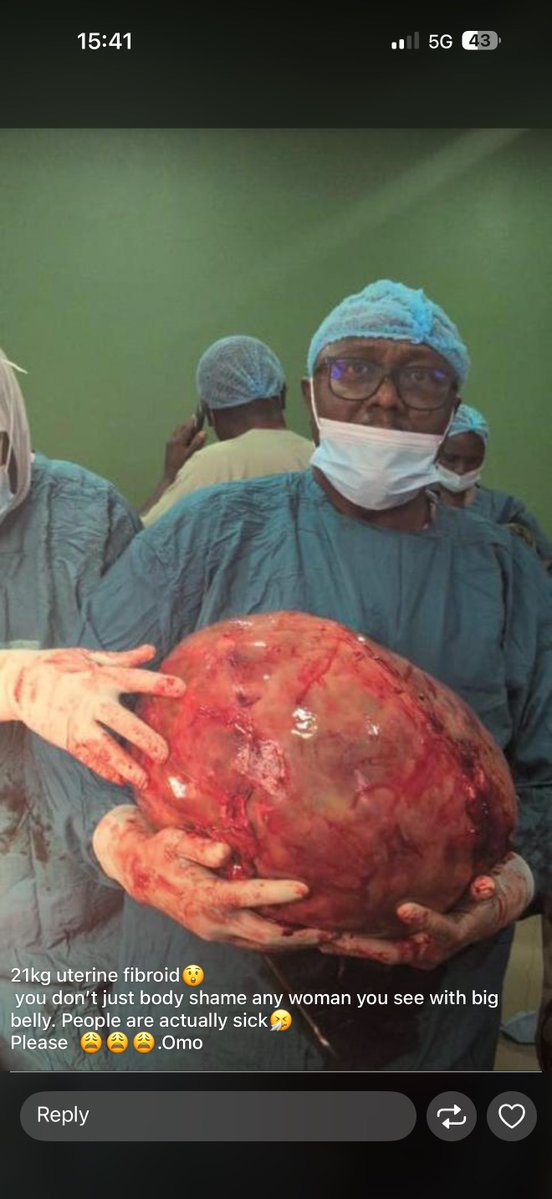 You mean this huge ass thing was in someone’s body?? Omg I want to virtually hug the person. I hope she even survived the operation. This looks soo large and scary🥲💔💔
