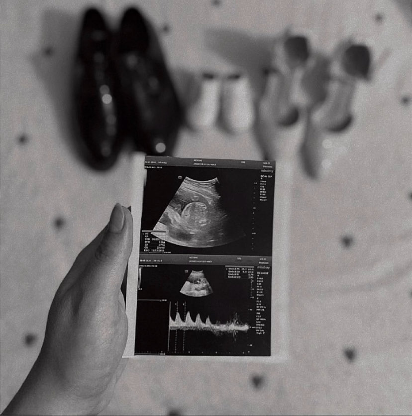 شُعور فائض tweet media