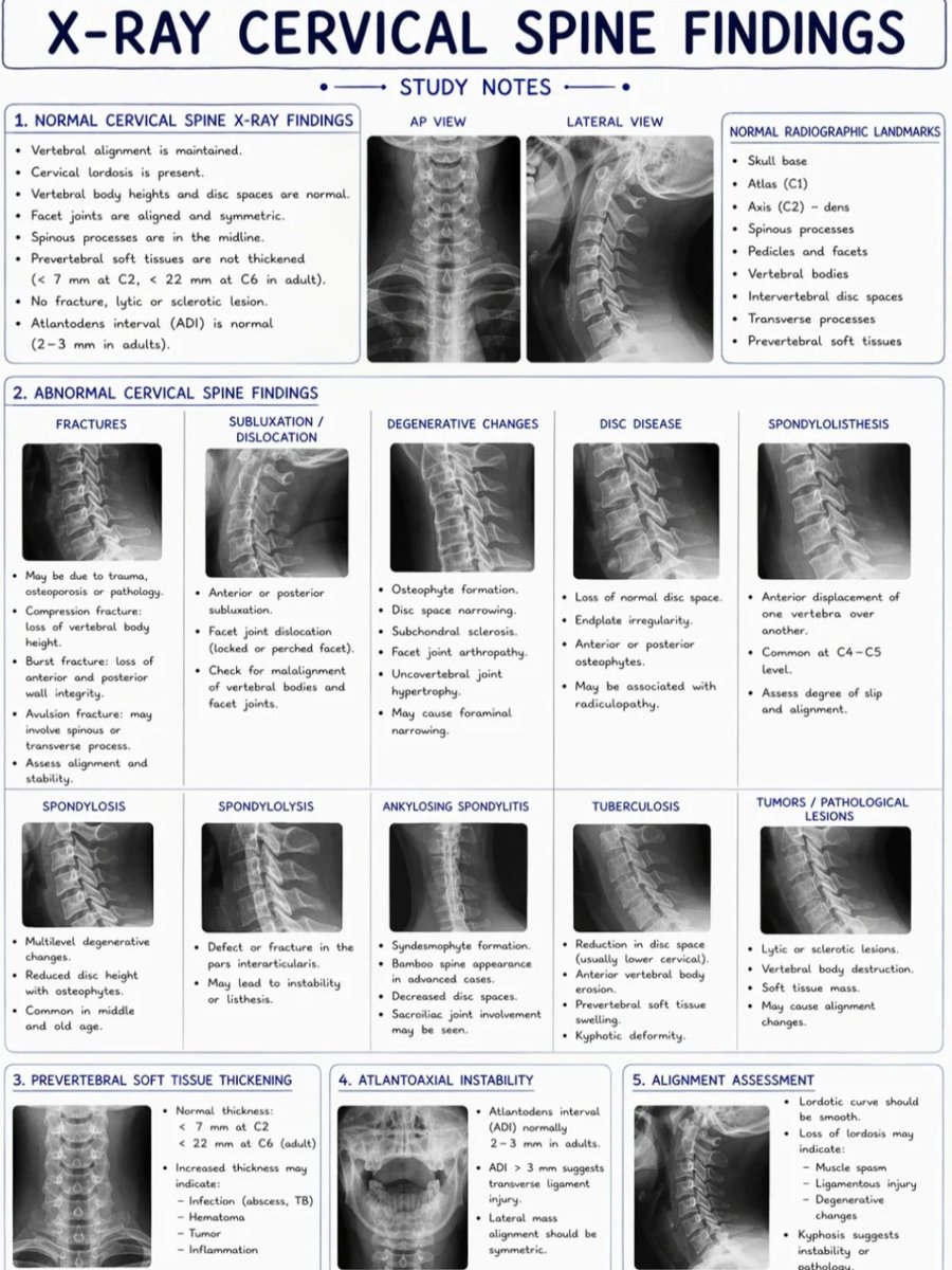 drsthanus's tweet photo. "X-RAY CERVICAL SPINE FINDINGS"

https://t.co/hs73YNLZXp https://t.co/NEWVF9aXzo