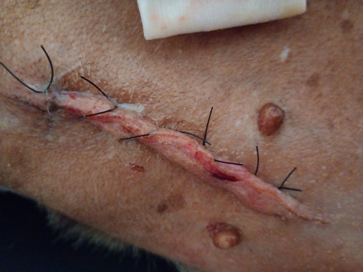 thaiannax's tweet photo. Pessoal, vamos continuar ajudando a cauzinha? 
Ela ainda precisa fazer exames muito importantes pra entender o que está acontecendo com a saúde dela… são exames de sangue, ultrassom na revisão do dia 7 de maio e também a tomografia, os exames neurológicos e cardiolgicos quando se recuperar da cirurgia . Além disso, tem os custos com medicações e todos os cuidados pós-cirúrgicos. Pra quem não acompanhou, ela passou por cirurgia recentemente, teve convulsões novamente e desde então não está bem… não está se alimentando direito, nem bebendo água sozinha 😢 Estou fazendo tudo que posso, mas sozinha está muito difícil. Qualquer valor, de verdade, qualquer 1 real já faz diferença pra conseguir cuidar dela e dar o tratamento que ela precisa 🙏

💸 Pix (CPF): 14998339702

Se você não puder ajudar com dinheiro, por favor, compartilha esse post… isso já ajuda muito mais do que você imagina ❤️ não soltem nossa mão não,por favor.. a luta ainda não terminou,preciso de vcs 😥 pra quem chegou agora, nos posts abaixo está toda história da cauzinha 🥺