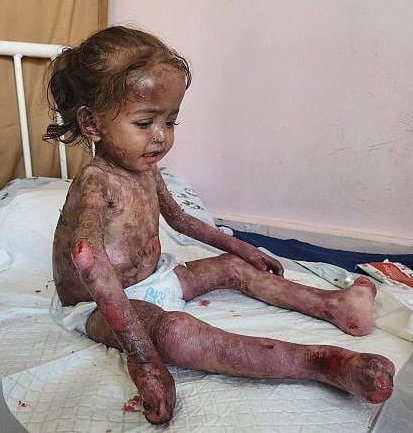 🎒 Abu Ali tweet media