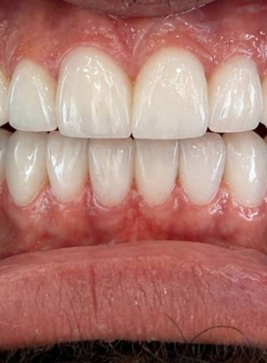 معلق tweet media