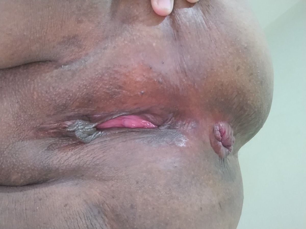 BBW 🩷 tweet media